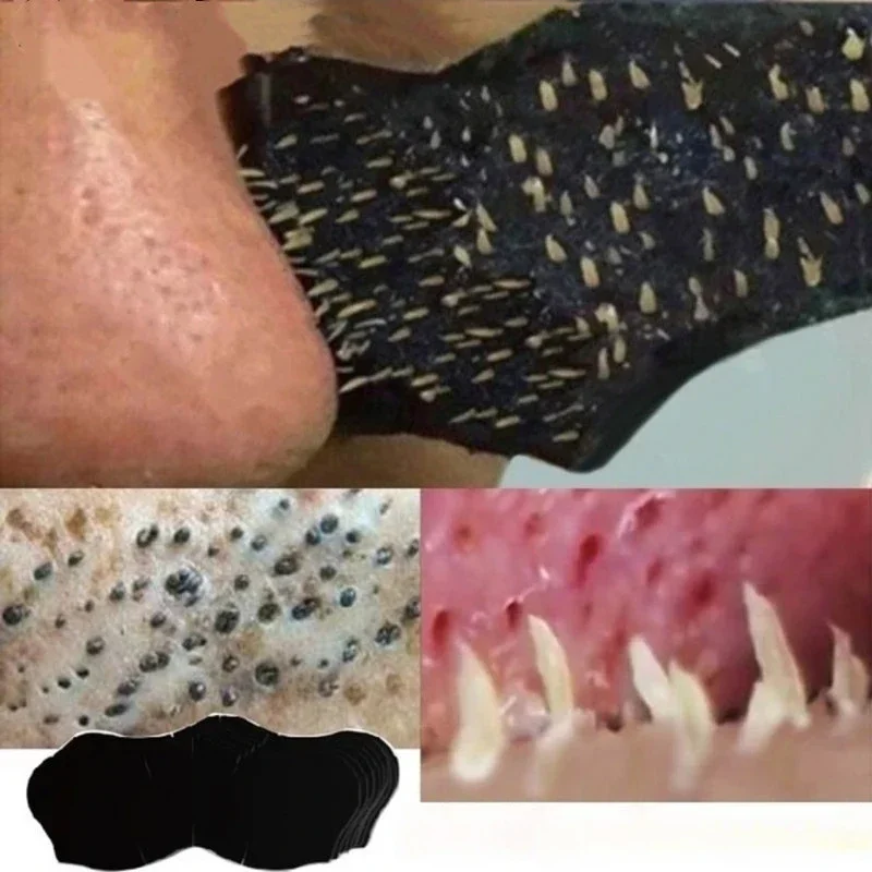Skincare Indonesia - Unissex cravo remover máscara tiras nasais