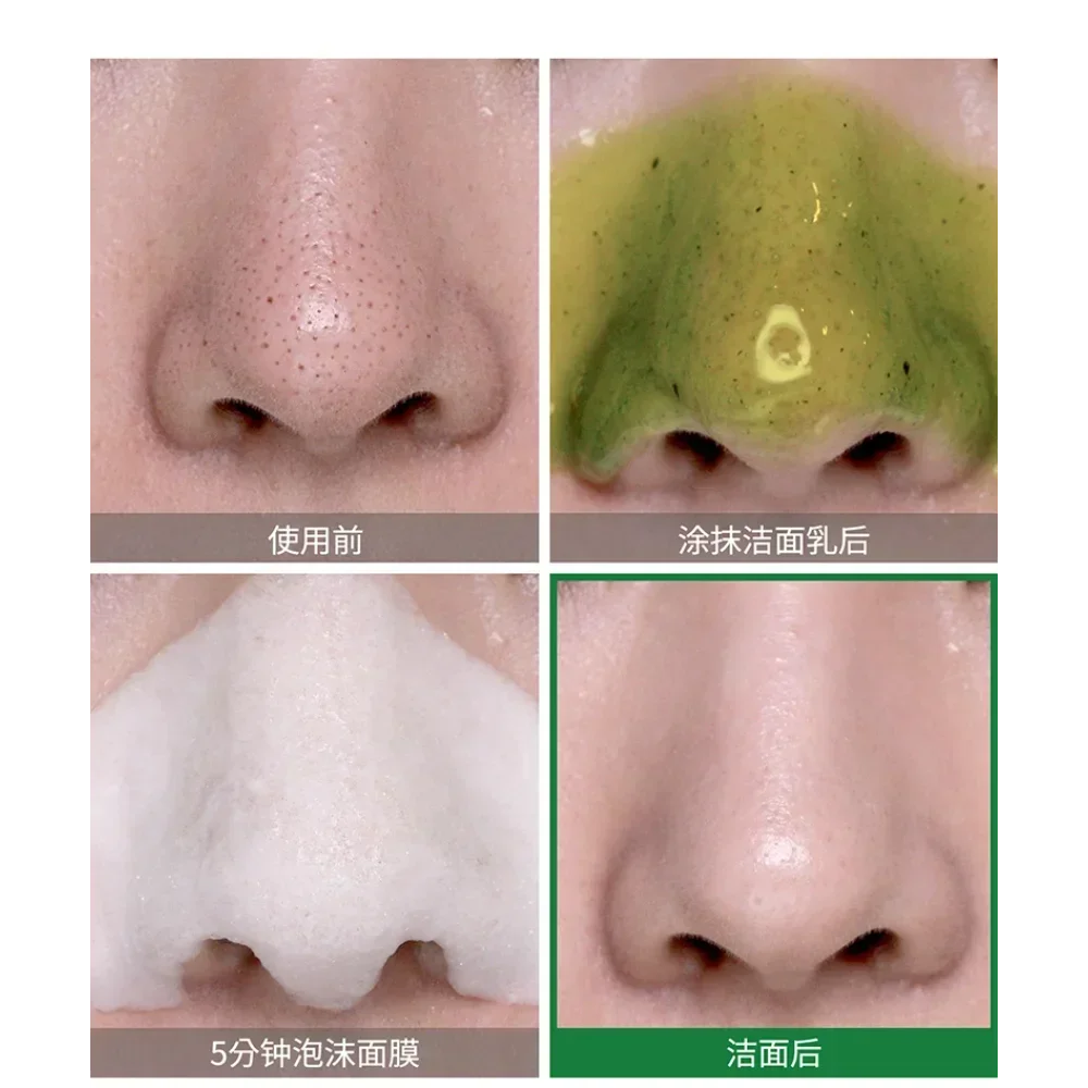 Coreia SOME BY MI Bye Bye Blac - Skincare Some By Mi avaliação e preço
