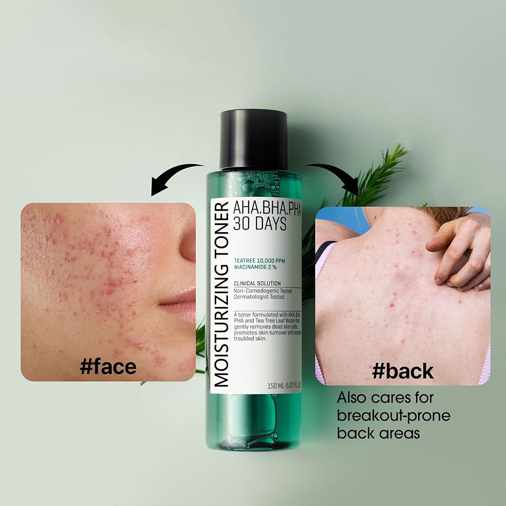 Some by Mi Aha.Bha.Pha 30 Days - Skincare Some By Mi avaliação e preço
