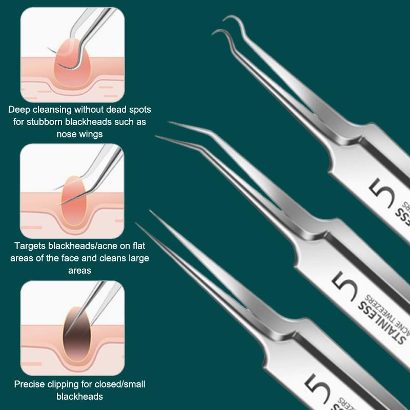 Kit Profissional de Remoção de - Skincare You avaliação e preço